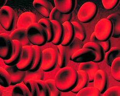 Accumulation of ketone bodies in diabetic blood